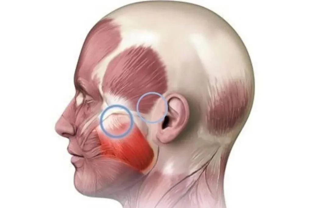Гнатологическое лечение челюстных суставов Гнатологическое лечение челюстных суставов