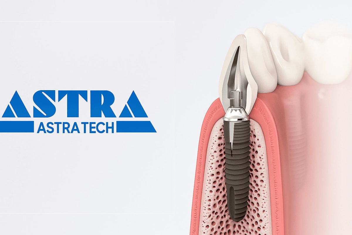 Имплант (Астра-Тек) Astra Tech имплантация и протезирование Имплант (Астра-Тек) Astra Tech имплантация и протезирование