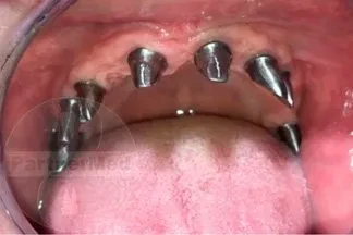 Лечение заболеваний ВНЧС Лечение заболеваний ВНЧС